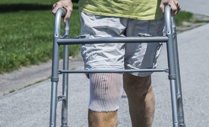 Shop Assistant Suffers Serious Knee Injury